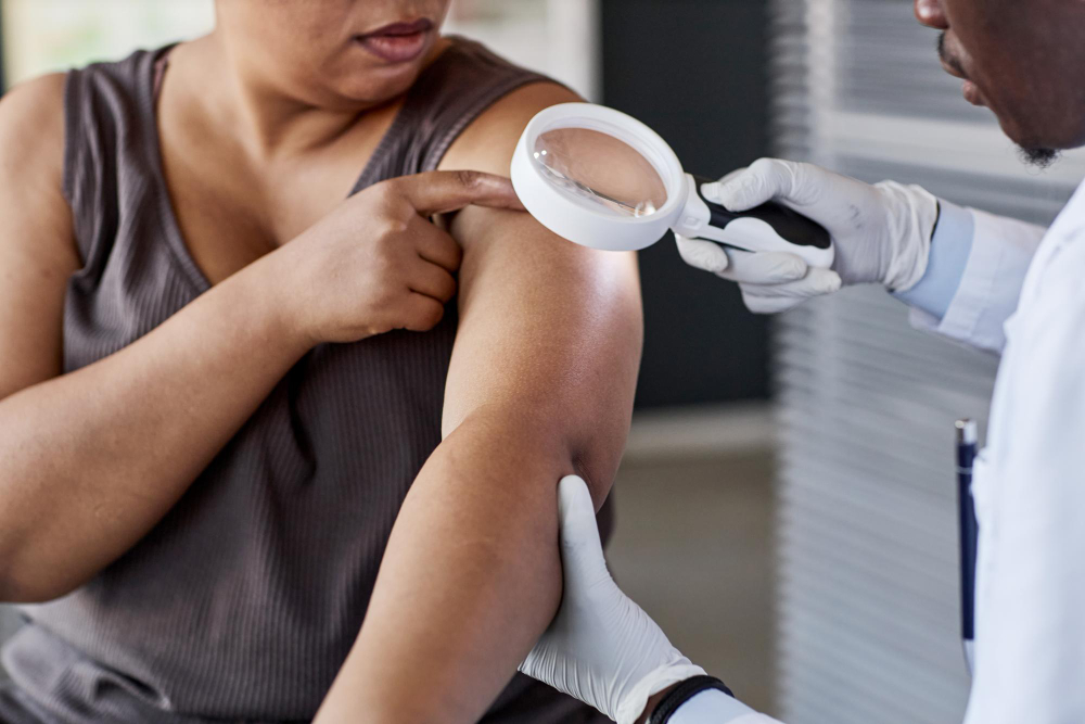 Skin Cancer Detection and Treatment